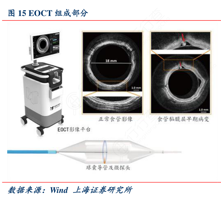 EOCT组成部分